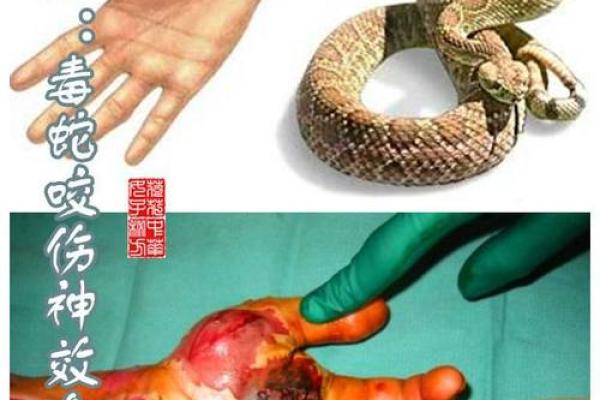梦到被蛇咬是什么征兆 女性